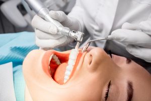 risks of removing wisdom teeth