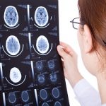 Brain scans showing catastrophic personal injury due to medical errors in Portland