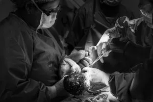 Una operación de cesárea en el hospital de Portland.